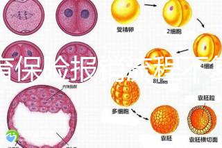 生育保險(xiǎn)報(bào)銷流程不復(fù)雜，辦理地點(diǎn)不分地域異地可報(bào)銷
