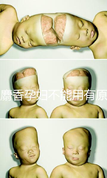 白麝香孕婦不能用有原因，流產、早產…這些危害不得不知