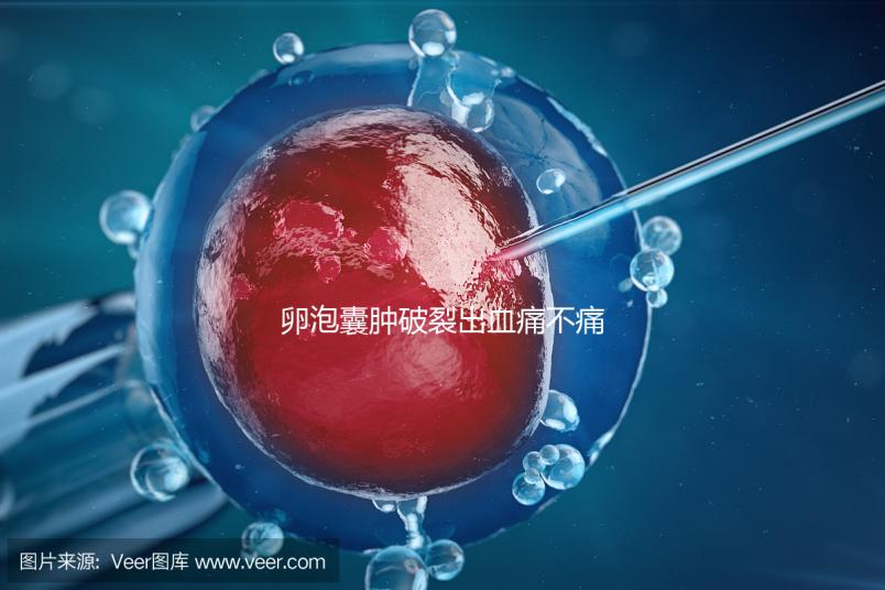 卵泡囊腫破裂出血痛不痛?經(jīng)歷過的姐妹們給出回應(yīng)