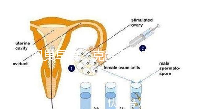 卵巢早衰,克齡蒙和芬嗎通藥物選擇引爭議