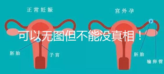 可以無圖但不能沒真相！段濤大夫帶你了解B超檢查報告單