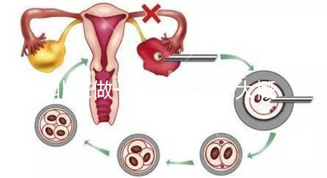 北京做一次試管嬰兒大概花多少錢？2025年價格及明細清單一覽！