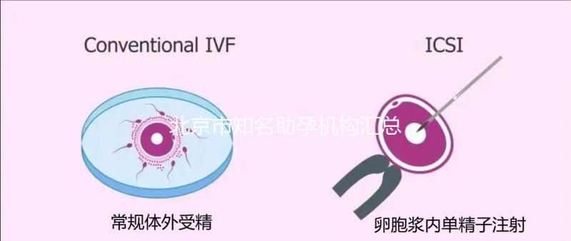 北京市知名助孕機(jī)構(gòu)匯總，成功率多少一看便知！