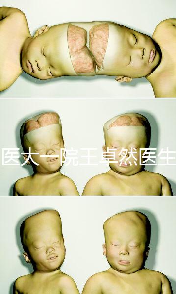 哈醫大一院王卓然醫生試管攻略,坐診時間、成功率早知道