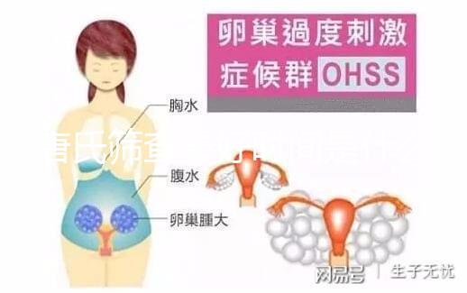 唐氏篩查最好時間是什么時候,內蒙古單項費用不超三百