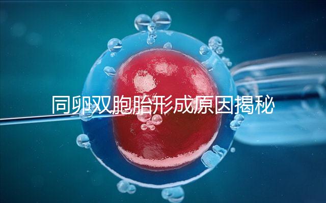 同卵雙胞胎形成原因揭秘，發(fā)育過程圖帶你弄清其中原理