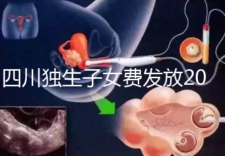 四川獨(dú)生子女費(fèi)發(fā)放2024年新規(guī)定，如何盡快領(lǐng)取自貢？