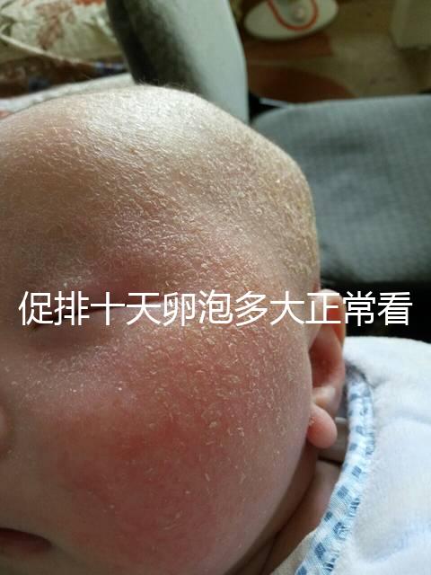 促排十天卵泡多大正?？催@，1.1×0.9符不符合一文說清