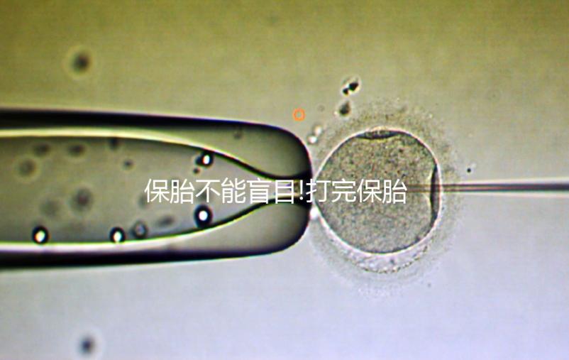 保胎不能盲目!打完保胎針寶媽們還需注意這3點(diǎn)