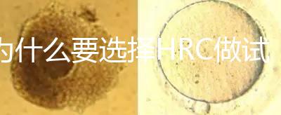 為什么要選擇HRC做試管？這6大優(yōu)勢看完就知道答案