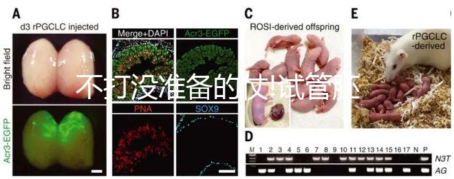 不打沒準(zhǔn)備的仗!試管胚胎移植前做好這6點(diǎn)才能事半功倍