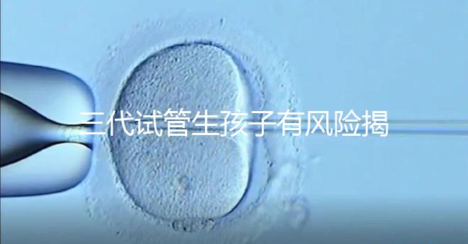 三代試管生孩子有風(fēng)險(xiǎn)揭秘嗎?嬰兒會(huì)有問題嗎?