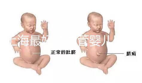 上海最好的試管嬰兒醫院信息匯總，想要最權威真得看這幾家