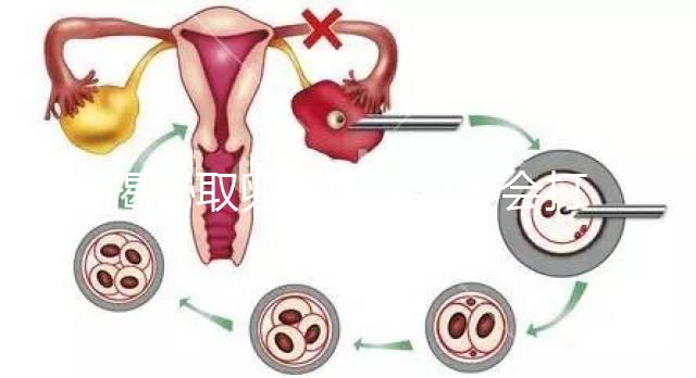 揭秘取卵后醫生會不會打電話問選幾代？這些問題會涉及到