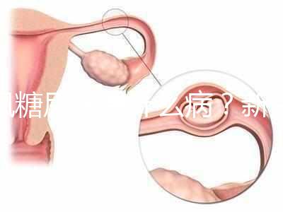 楓糖尿病是什么?。啃律鷥哼@5個指標偏低要注意了
