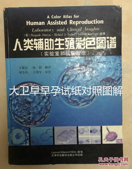 大衛早早孕試紙對照圖解，教你怎么看結果是不是陽性