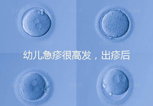 幼兒急疹很高發(fā)，出疹后的護理方法及注意事項提前知曉！