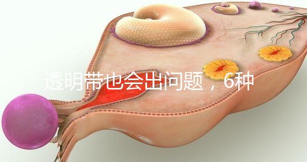 透明帶也會(huì)出問(wèn)題，6種異常類型形成原因不同