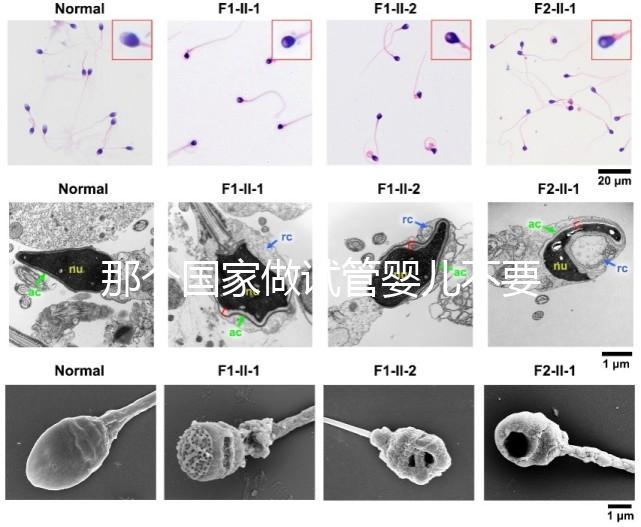 那個(gè)國(guó)家做試管嬰兒不要結(jié)婚證