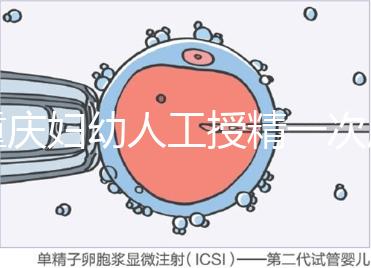 重慶婦幼人工授精一次成功率揭秘，移植費用貴有原因