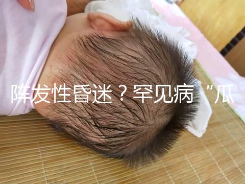陣發(fā)性昏迷？罕見病“瓜氨酸血癥”請(qǐng)了解下！