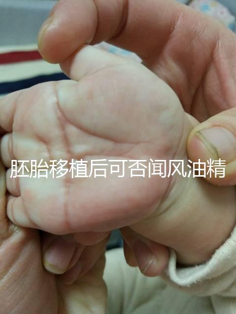 胚胎移植后可否聞風油精速覽，導致著床失敗真不是鬧著玩