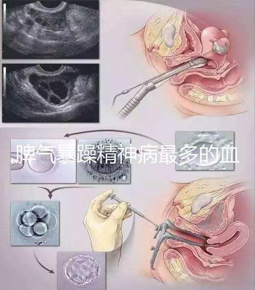 脾氣暴躁精神病最多的血型竟是…，4大血型隱藏了不同疾病