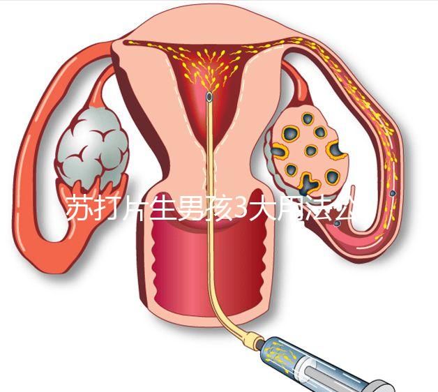 蘇打片生男孩3大用法公布，同房塞陰還是口服分情況