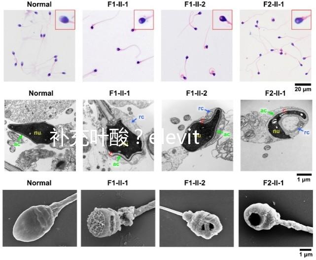 補(bǔ)充葉酸？elevit愛(ài)樂(lè)維那你不得不了解