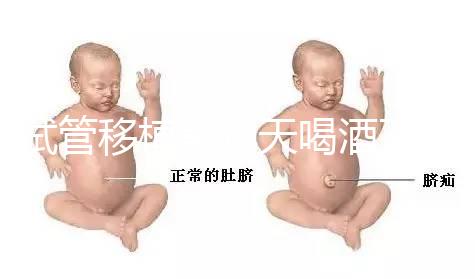 試管移植前幾天喝酒了有影響嗎？想要懷孕得管住嘴！