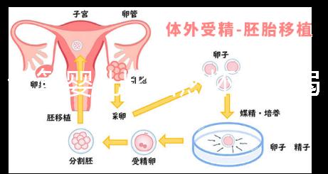 試管嬰兒比自然懷孕脆弱原因來襲，正不正常三分鐘說清