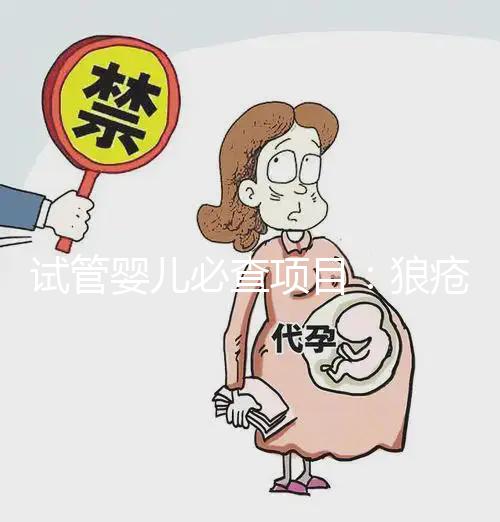 試管嬰兒必查項目：狼瘡抗凝物，知道LAC到底是檢查什么嗎？