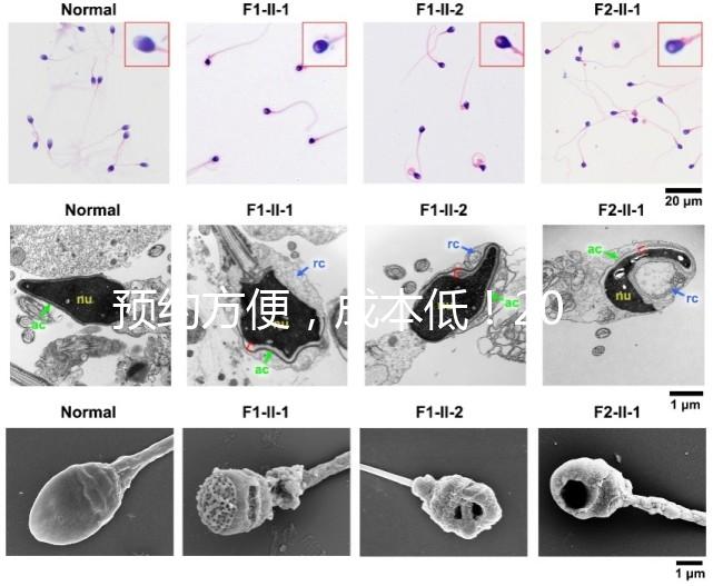 預(yù)約方便，成本低！2024年西安新城、臨潼、雁塔四維彩超指南