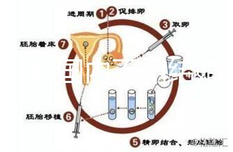 2024年國內(nèi)不用結婚證做試管嬰兒的醫(yī)院排名一覽